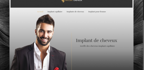 https://www.implantcheveux.fr